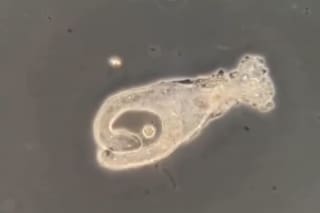 Así actúa el naegleria fowleri, el extraño microorganismo que contrajo el niño fallecido en Catamarca
