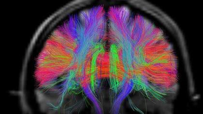 La neuroplasticidad es la competencia que tienen las neuronas y redes neuronales para cambiar sus conexiones y comportamientos en respuesta a nueva información
