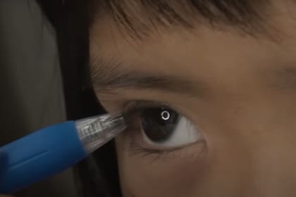 La NIÑA decidió someterse a una cirugía plástica en los ojos por insistencia de su madre (Foto:Captura YouTube)