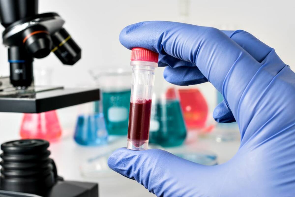 La noticia salió en la revista The Lancet HIV, donde sugieren que los resultados de los análisis representan una curación del VIH