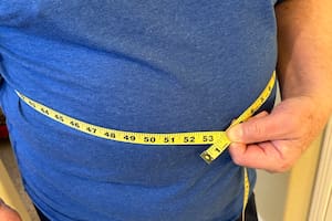 Qué es el síndrome CKM, la nueva condición que vincula a la obesidad con el daño cardíaco y renal