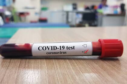 La OMS bautizó a la enfermedad provocada por el nuevo coronavirus como Covid-19, nombre que no se refiere a una ubicación geográfica, un animal, un individuo o un grupo de personas