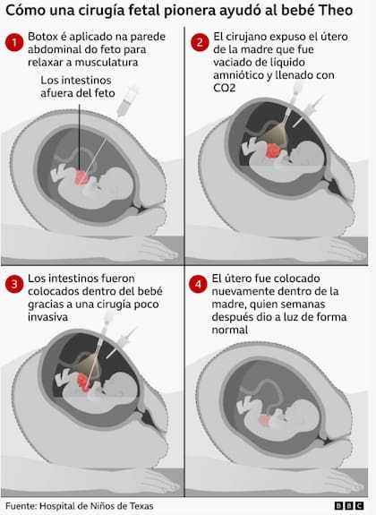 La operación fue un éxito