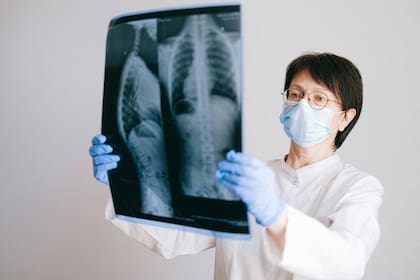 La osteoporosis provoca una disminución progresiva de la resistencia de los huesos