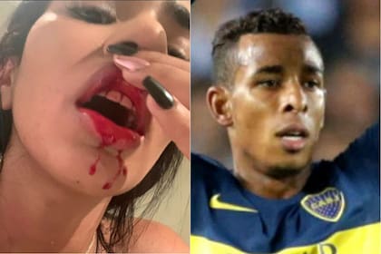 La pareja de Sebastián Villa lo acusó de haberla golpeado repetidamente en los "ultimos dos años"