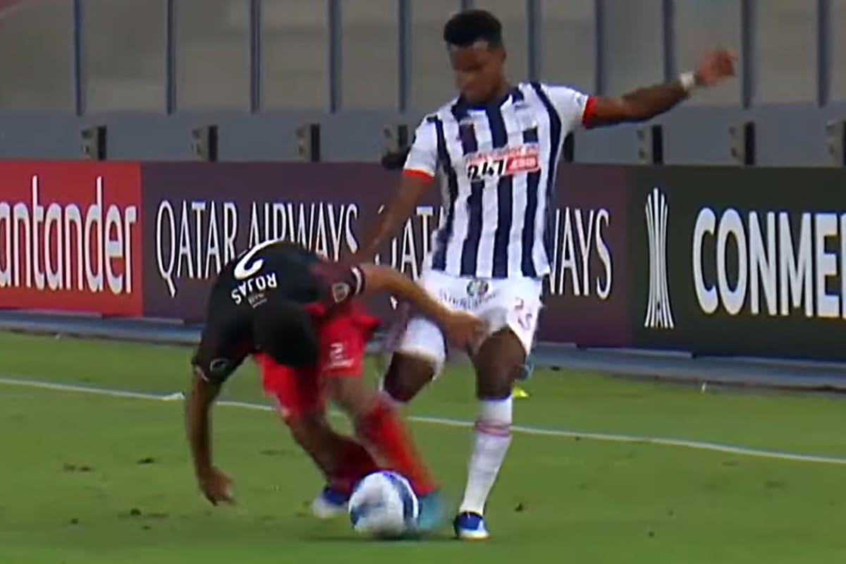 La patada de Aldair Rodríguez a Robert Rojas en el estreno de Alianza Lima y River por la Copa Libertadores; el paraguayo tiene fracturas de tibia y peroné y pasará tres o cuatro meses sin jugar.