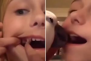 La pequeña filmó mientras el loro sacó su diente flojo con el pico (Foto: Captura Instagram @elchamainforma)