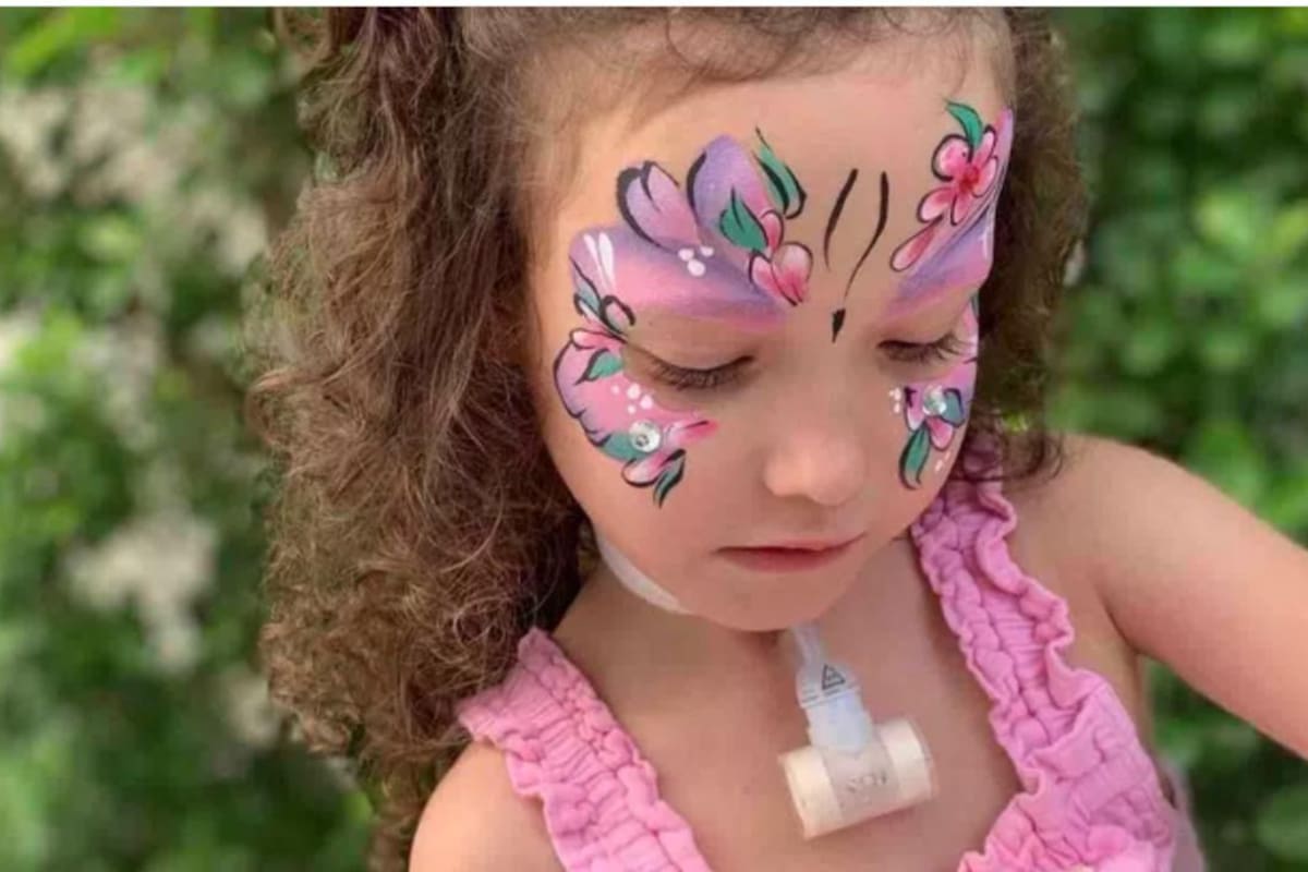 La pequeña Sadie tiene un síndrome que solo afecta a cerca de mil personas en el mundo (Foto: GoFundMe)