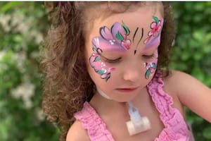 La pequeña Sadie tiene un síndrome que solo afecta a cerca de mil personas en el mundo (Foto: GoFundMe)