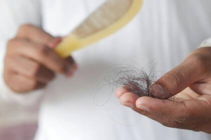 La pérdida del cabello preocupa a millones de personas alrededor del mundo