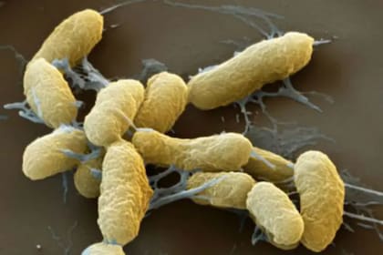 La peste bubónica es una infección bacteriana grave que es transmitida, principalmente, por las pulgas que puede ser mortal si no se trata con antibióticos de inmediato