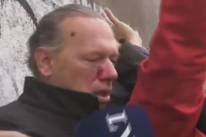 La Policía de la Ciudad acudió para retirar al ministro