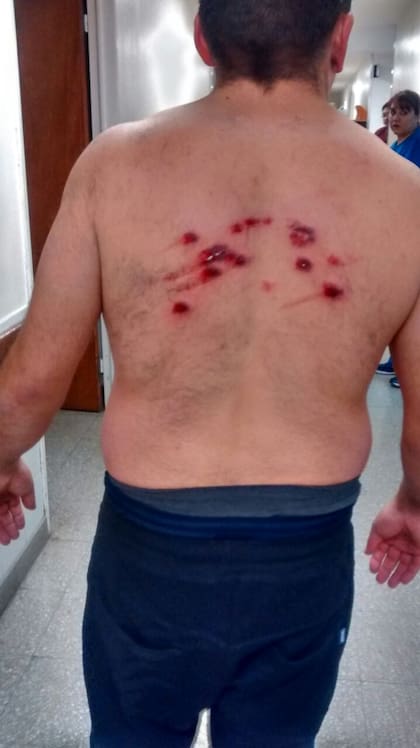 La policía en Santa Cruz reprimió con balas de goma