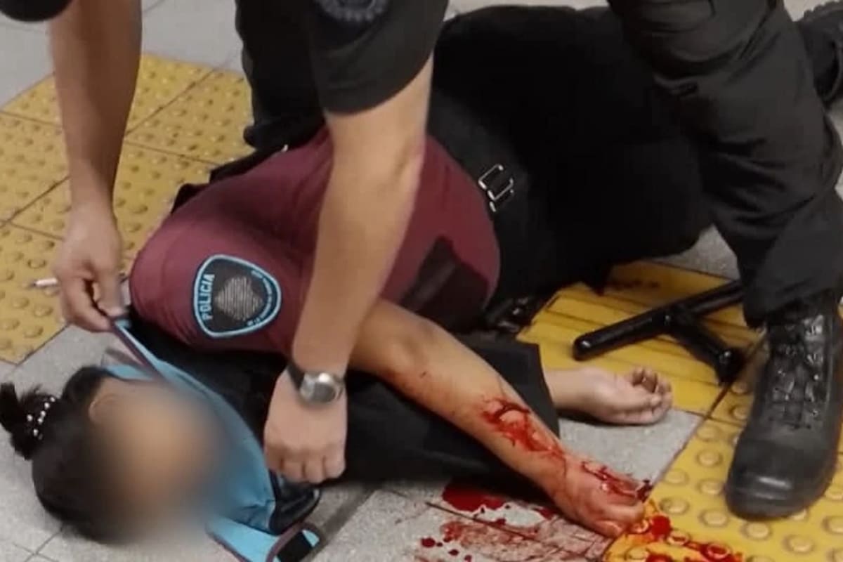 La policía herida en el subte
