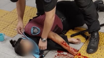 La policía herida en el subte