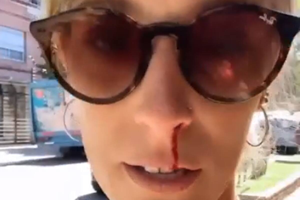 La popular instagramer Dani La Chepi fue víctima de un violento intento de robo en la vía pública