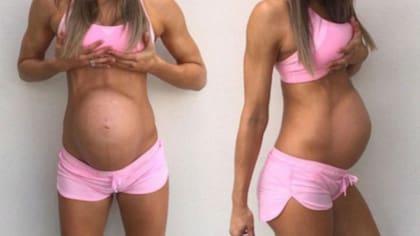 La pregorexia puede acarrear partos prematuros y abortos espontáneos, entre otros problemas