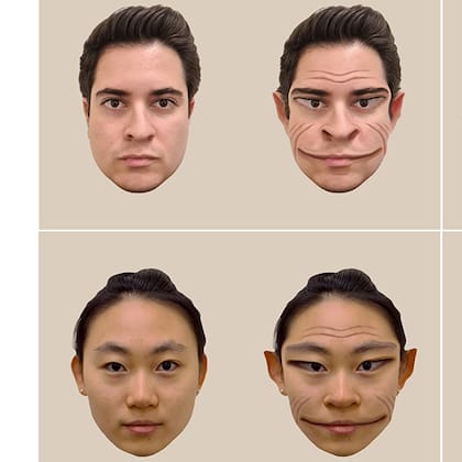 La prosopometamorfopsia (PMO) cuenta con aproximadamente 40 tipos distintos de distorsiones visuales
