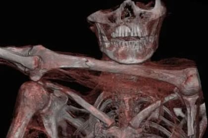 La punta de flecha que mató a Ötzi todavía está incrustada en su hombro