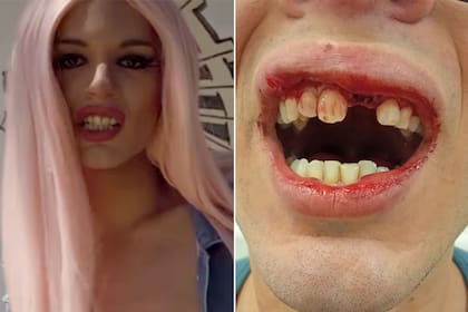 "La Queen de Fuerte Apache" fue atacada en la calle por un desconocido.