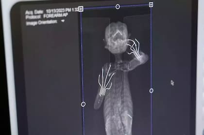 La radiografía de la momia "sirena"