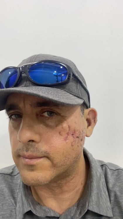 La recuperación de Hoyos fue "impresionante", según le dijeron sus médicos.