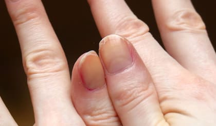 La relación entre las uñas y el envejecimiento biológico