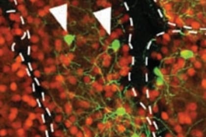 La reprogramación celular consiste en la inserción de genes creados sintéticamente en el laboratorio para decirle a esa célula en que tipo se desea que se transforme