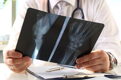 La residencia de traumatología es una de las especialidades más buscadas por los estudiantes de medicina