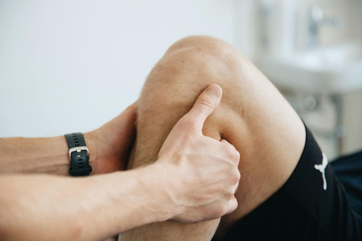 La ruptura del ligamento cruzado anterior (LCA) es común en personas jóvenes activas entre 15 y 45 años