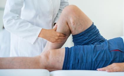 La salud vascular es muy importante en adultos mayores (Foto: El Tiempo)