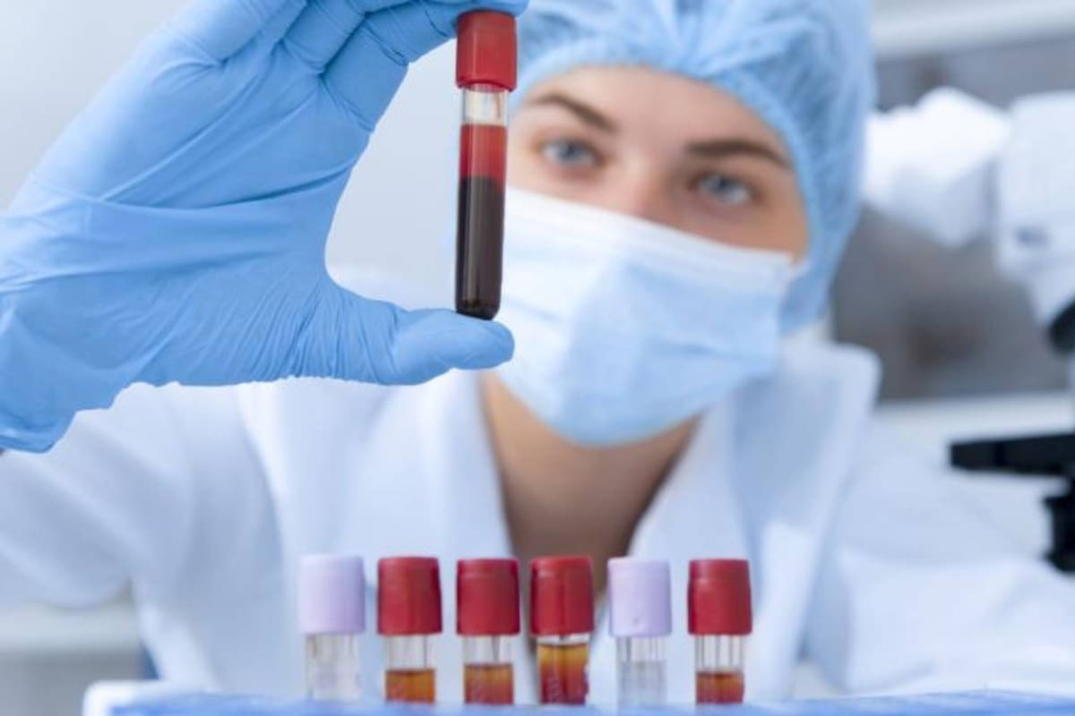 La "sangre dorada" forma parte de una mutación y los pacientes tiene un Rh nulo