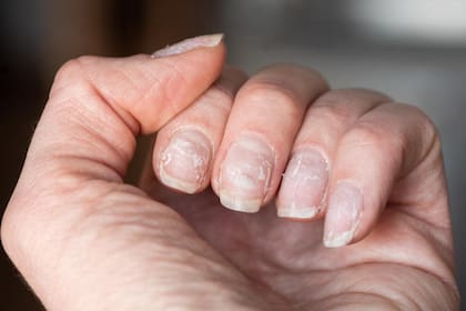 La solución al problema de uñas quebradizas y rotas: ¿Cómo curarlas?