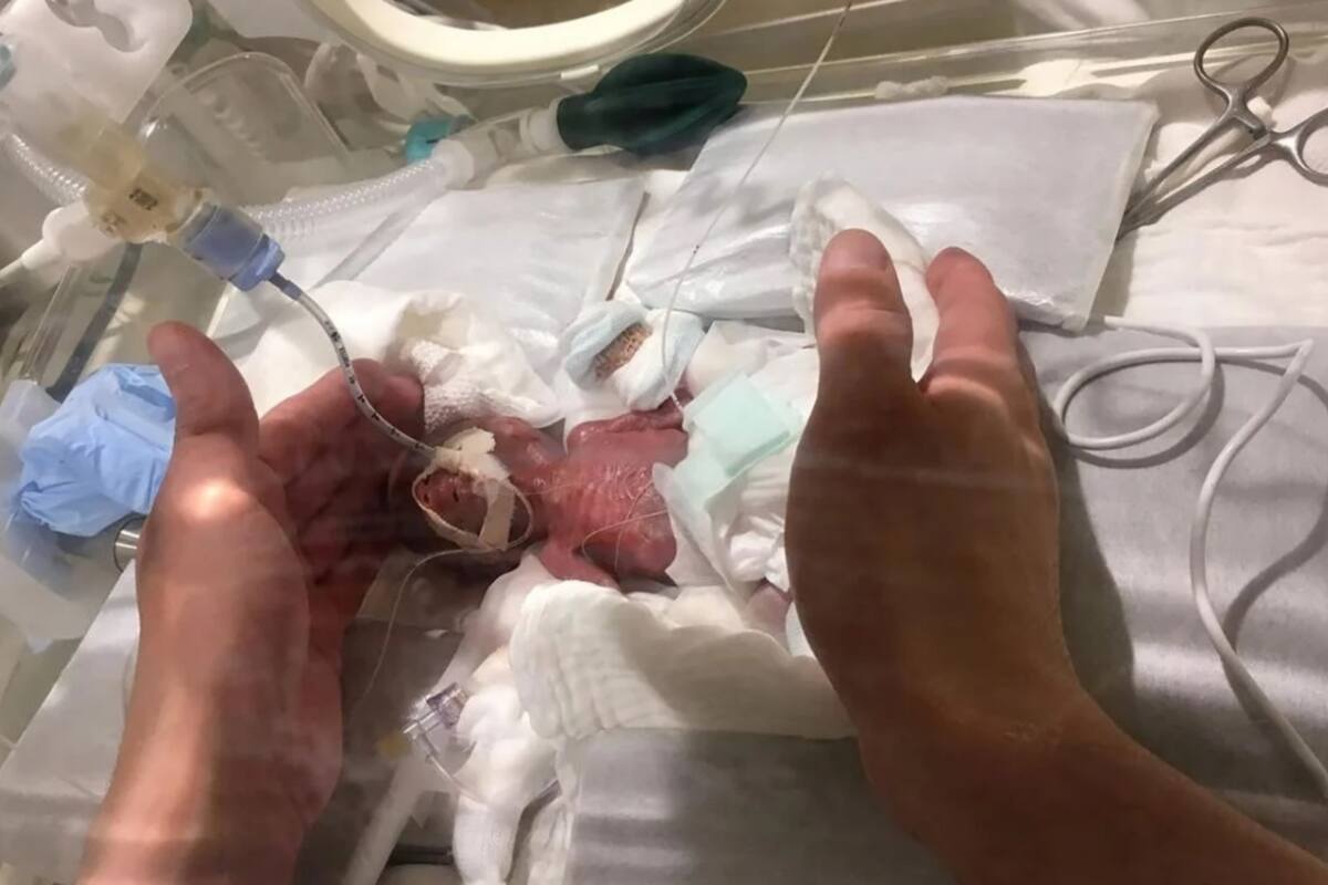 La tasa de supervivencia en casos así es muy baja