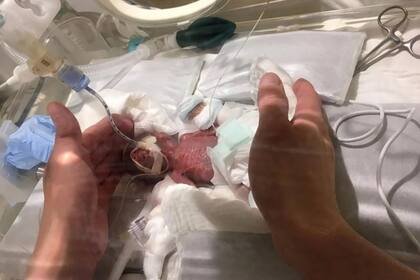 La tasa de supervivencia en casos así es muy baja