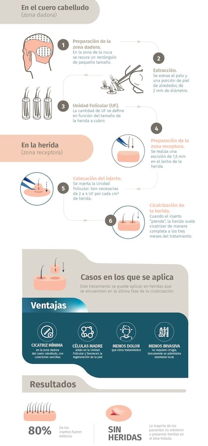 La técnica, paso a paso