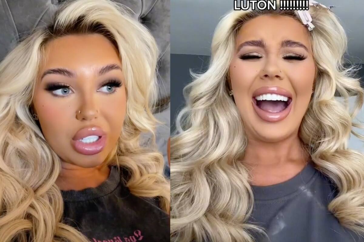 La tiktoker se hizo un procedimiento en los dientes que no pensó que la atormentaría por tanto tiempo