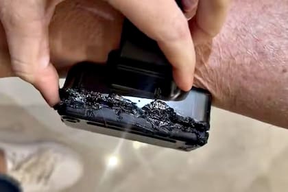 La tobillera que Bolsonaro intentó quemar