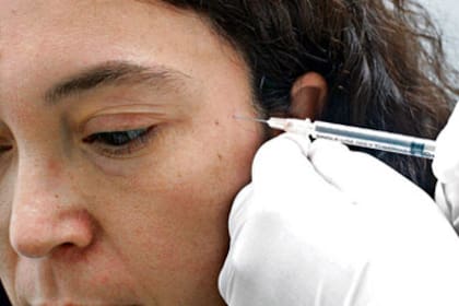 La toxina se aplica a través de inyecciones que relajan los músculos que causan las arrugas de expresión