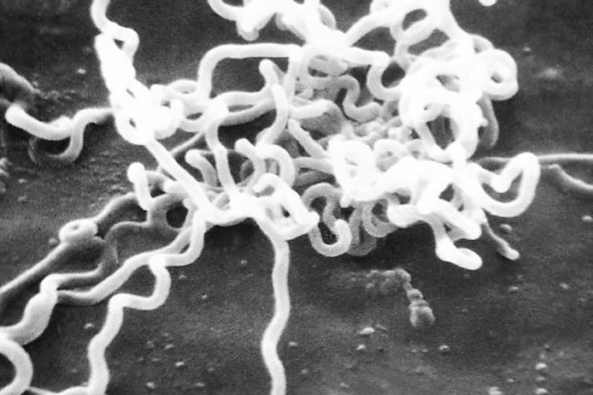 La Treponema pallidum es una bacteria que está detrás de cuatro enfermedades: pinta, bejel, pian y la más conocida, sífilis.
