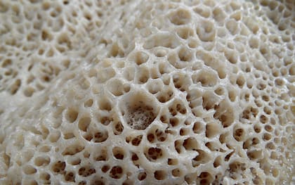 La tripofobia es el miedo o repulsión generado al mirar o al estar cerca de figuras geométricas muy unidas
