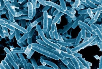 La tuberculosis es una enfermedad infecciosa que se transmite principalmente a través del aire cuando una persona infectada habla, escupe, tose o estornuda