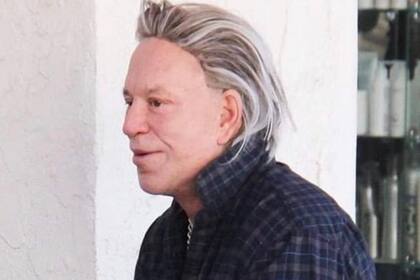 La última cirugía del actor.