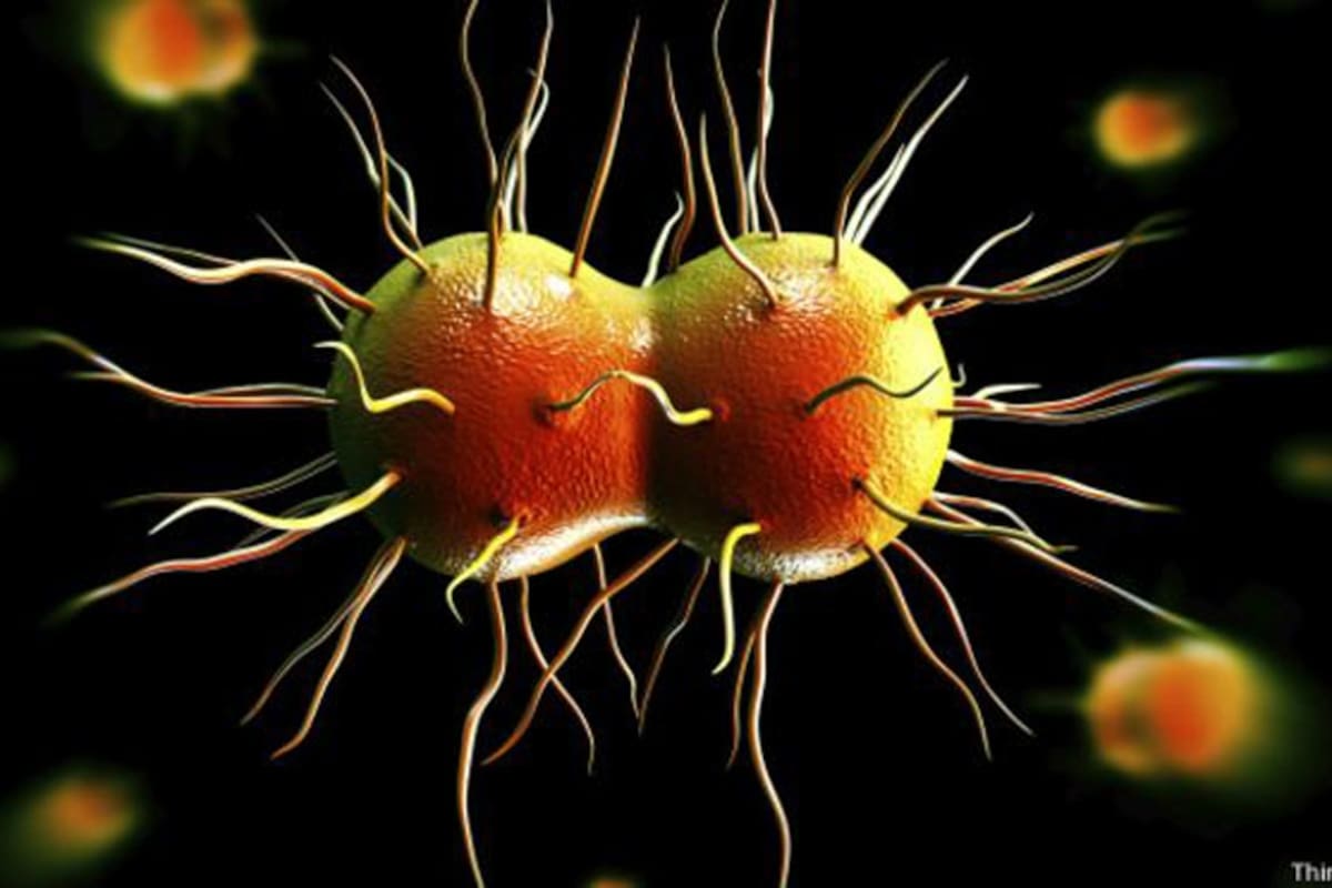 La vaginosis bacteriana puede derivar en enfermedades de transmisión sexual como la gonorrea