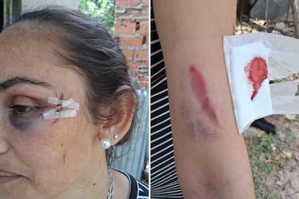 La víctima aseguró que no saben quiénes son las agresoras