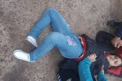 La víctima con su pierna quebrada como consecuencia del robo