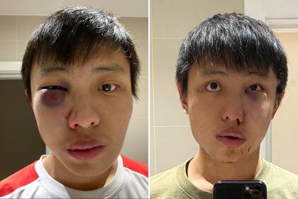 La víctima es un estudiante de Singapur y fue atacado en Londres Fuente: Facebook