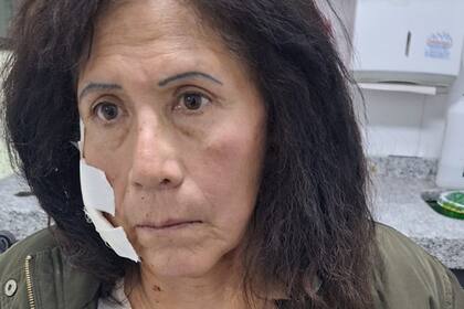 La víctima se dirigía al aeropuerto de Ezeiza para viajar a Italia