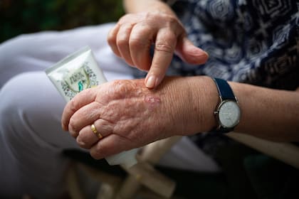 La vid del dios del trueno puede ser administrada tanto por vía oral como tópica