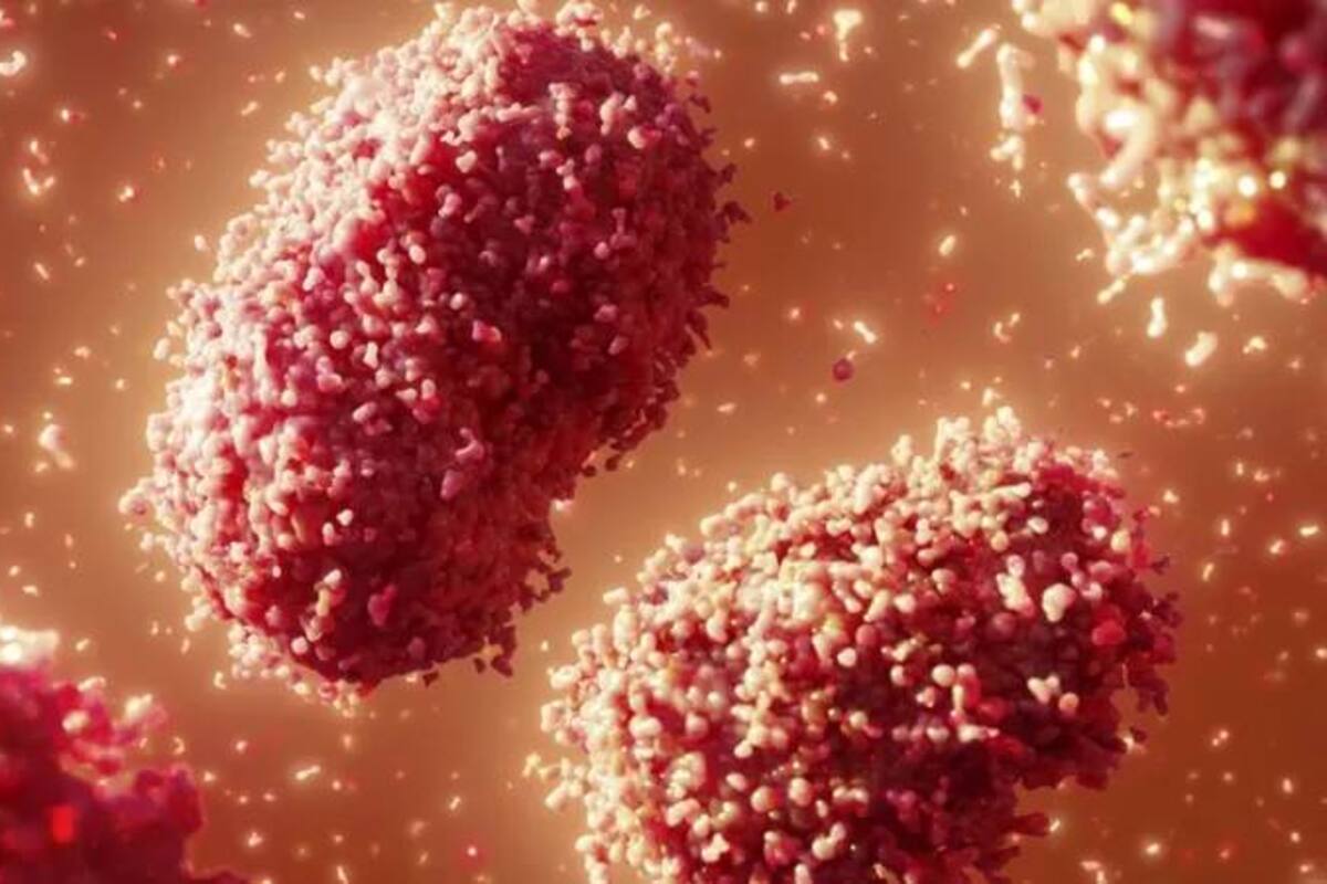 La viruela del simio es una enfermedad viral rara endémica en algunos países africanos